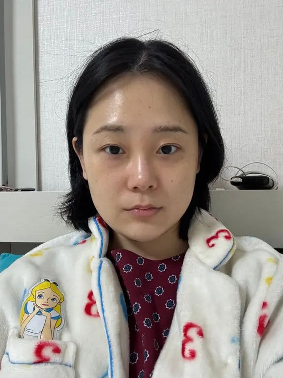 Transformation Case 1